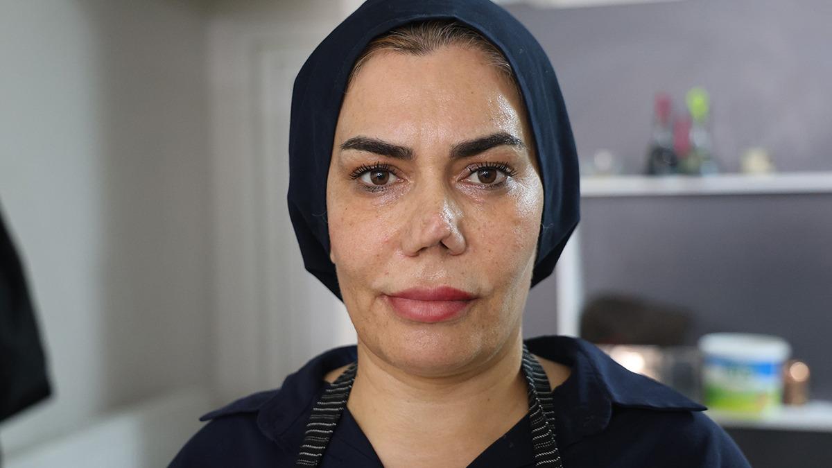 Burnu Kırılan